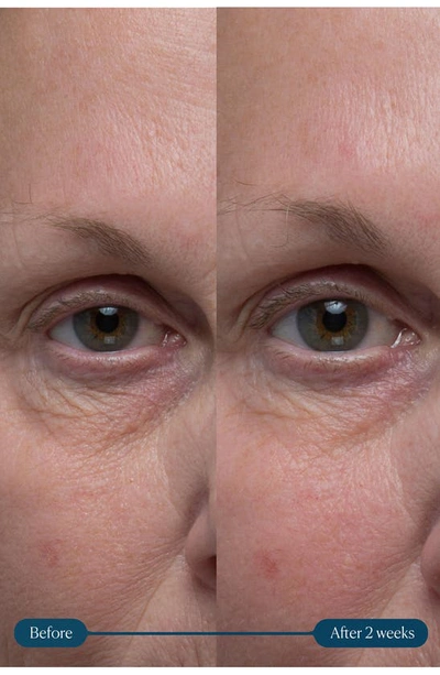 Elemis Pro Collagen Vitality Eye Cream 0.5 Oz.