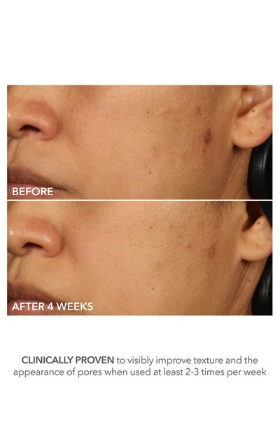 Dr Dennis Gross Skincare Dr. Dennis Gross Skincare Advanced Retinol + Ferulic Perfectly Dosed Extra Strength 0.5% Treatment P