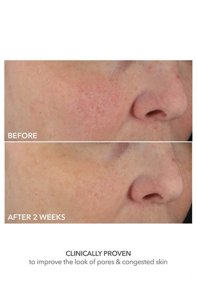 Dr Dennis Gross Skincare Dr. Dennis Gross Skincare Advanced Retinol + Ferulic Perfectly Dosed Retinol Universal 0.2%