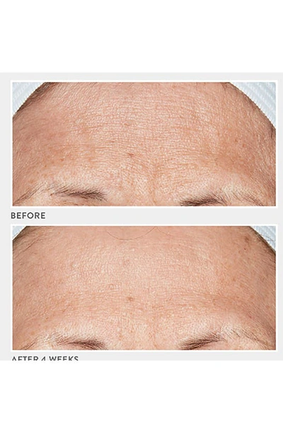 Shop Lancer Skincare Advanced Retinol Treatment, 1 oz