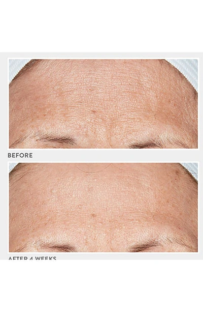 Lancer Skincare Advanced C Radiance Treatment With Vitamin C Collagen With Vitamin C Collagen Cofactor 10x (1.7 Fl.