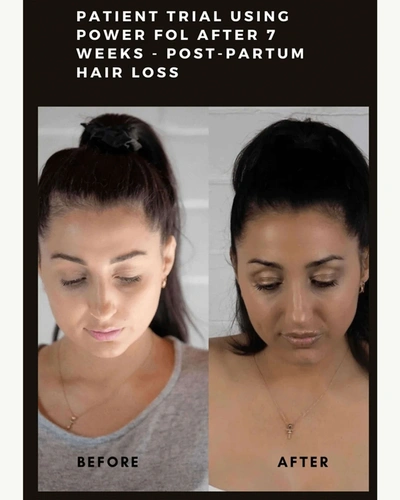 Shop Maya Chia Power Fol Multi-correctional Scalp And Hair Treatment