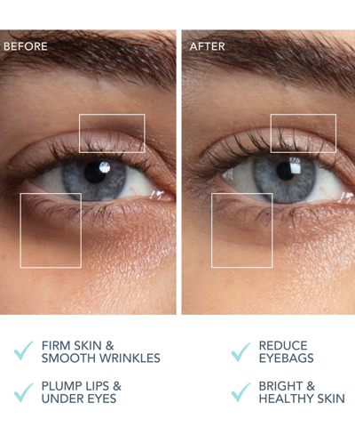 Foreo Faq 101 Professional Radiofrequency Led Facial Rejuvenation In No Color