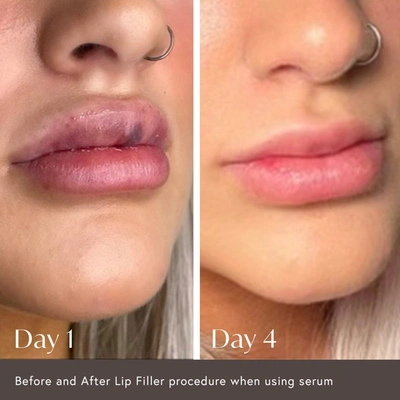 Viktor Michael Hidden Agenda Pre And Post Injection Care Serum In Default Title
