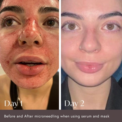 Viktor Michael Hidden Agenda Pre And Post Injection Care Serum In Default Title