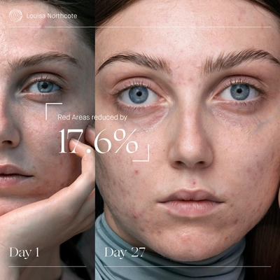 Augustinus Bader The Rich Cream In 3.4 Fl oz