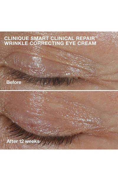 Shop Clinique De-aging Skin Care Experts Set (limited Edition) $117 Value