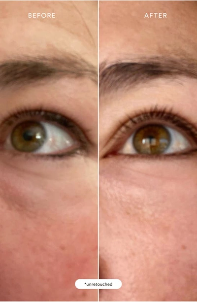 True Botanicals Resurrection Radiance Eye Cream