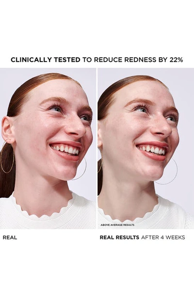It Cosmetics Bye Bye Redness Concentrated Derma Serum