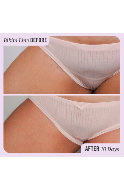 First Aid Beauty Ingrown Hair Treatment Pads (28 Pads)