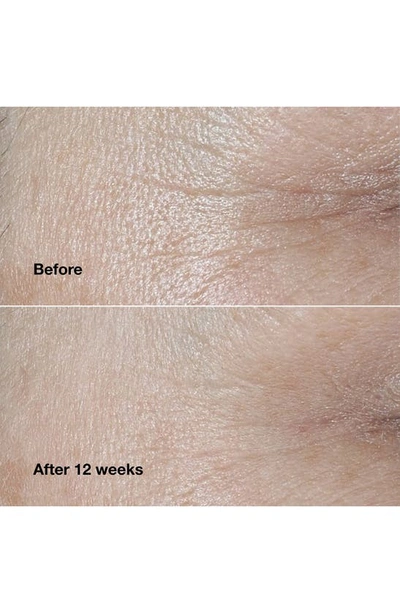 Clinique Smart Clinical Repair Wrinkle Correcting Face Cream