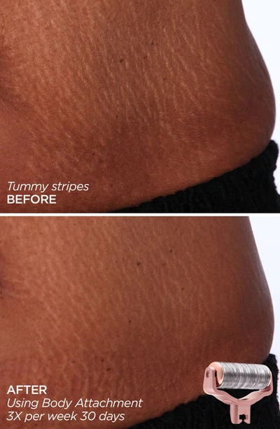 Beautybio Glopro® Skin That Glitters Set