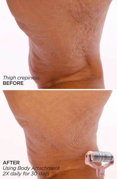 Beautybio Glopro® Skin That Glitters Set