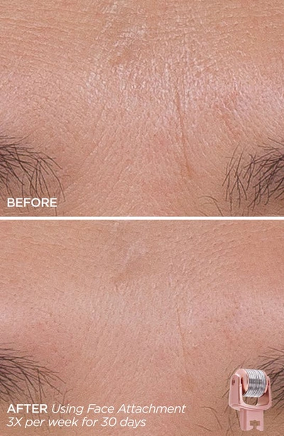 Beautybio Glopro® Skin That Glitters Set