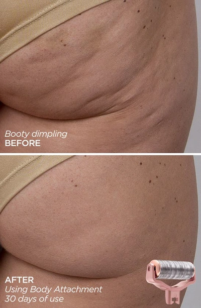 Beautybio Glopro® Skin That Glitters Set