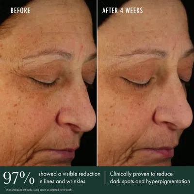 Revive Brightening Serum In Default Title