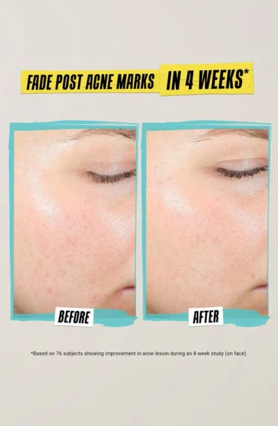 Kiehl's Since 1851 Expertly Blemish-treating And Preventing Lotion
