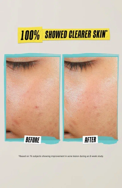 Kiehl's Since 1851 Expertly Blemish-treating And Preventing Lotion