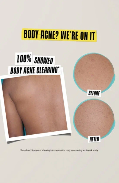 Kiehl's Since 1851 Truly Targeted Acne Clearing Solution With Salicylic Acid 0.5 Oz.