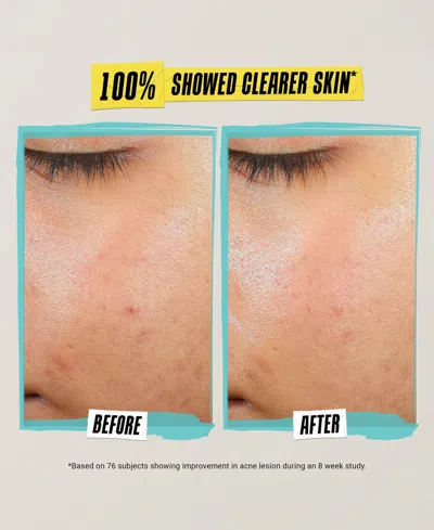 Shop Kiehl's Since 1851 Expertly Clear Acne-treating & Preventing Lotion In No Color