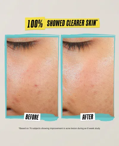 Kiehl's Since 1851 Expertly Clear Acne-treating & Preventing Lotion In No Color