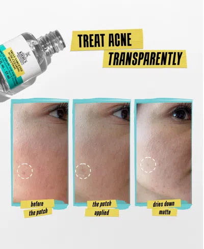 Kiehl's Since 1851 Truly Targeted Acne Clearing Solution With Salicylic Acid 0.5 Oz. In No Color