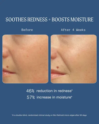 Kinship Dreamwave 2% Bio-retinoid Complex Overnight Serum