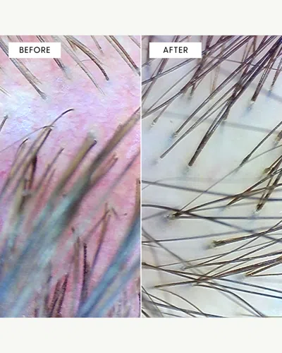 Arey Calm It Down Scalp Repair