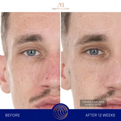 Augustinus Bader The Retinol Serum In 1.7 oz