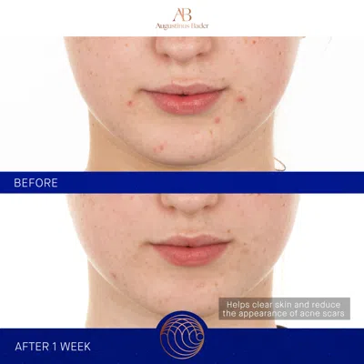 Augustinus Bader The Retinol Serum In 1.7 oz