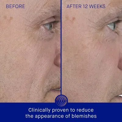 Augustinus Bader The Serum In 1.7 Fl oz