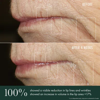 Revive Advanced Lip Perioral Serum Targeted Vertical Line Filler In Default Title
