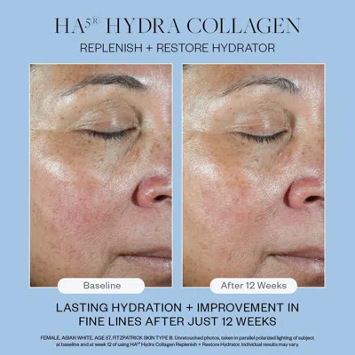 Skinmedica Ha5 Hydra Collagen Replenish And Restore Hydrator 60ml