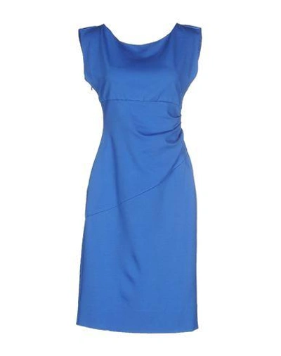 Shop Diane Von Furstenberg Knee-length Dresses In Blue