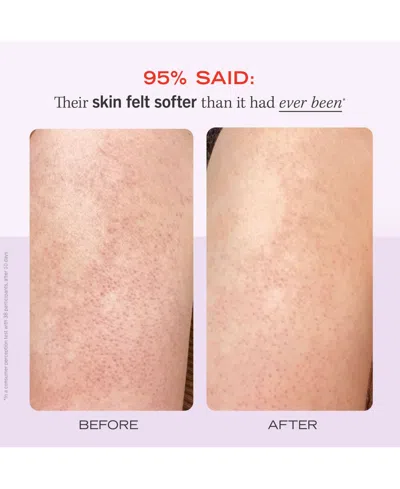 First Aid Beauty Kp Bump Eraser Body Scrub With 10% Aha In No Color