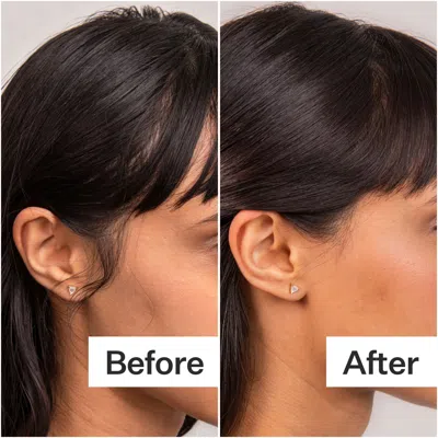 Act+acre 4% Niacinamide Oily Scalp Serum