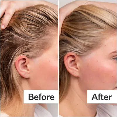 Act+acre 4% Niacinamide Oily Scalp Serum