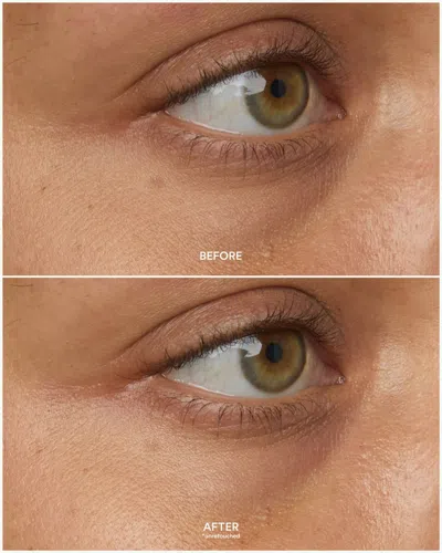 True Botanicals Chebula Multi-corrective Eye Patches