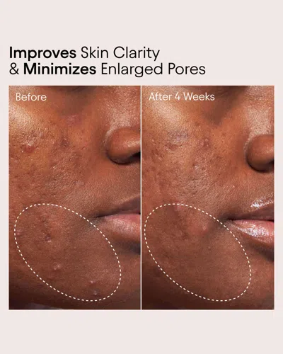 Alpyn Beauty Pore Perfecting Liquid With 2% Bha + Borage