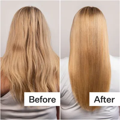 Act+acre Daily Hydro Scalp Serum With Hyaluronic Acid For Dry Scalp