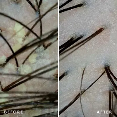 Virtue Scalp Remedy Conditioner For Scalp And Hair Health