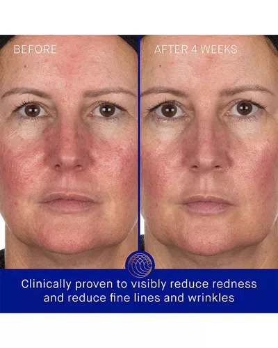 Augustinus Bader The Hydrogel Face Mask