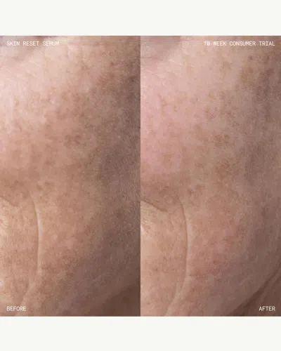 Emma Lewisham Skin Reset Serum