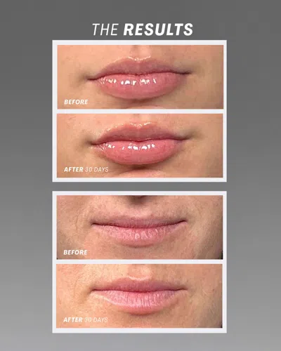 The Outset Lip Oasis Glossy Treatment In Transparent
