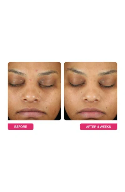 Beautystat Universal Triple Action Peel Pads 10-pack In No Color