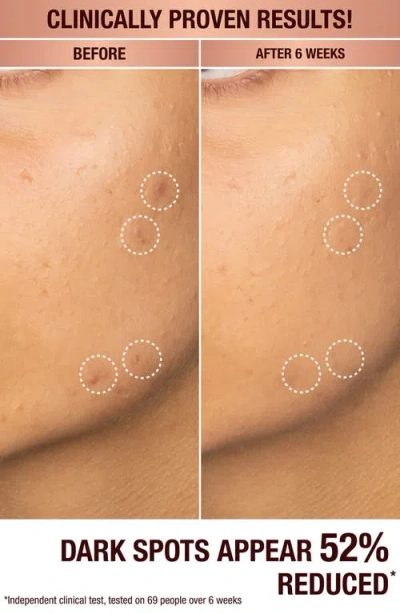 Charlotte Tilbury Dark Spot Correcting Radiance Recovery Serum In No Color