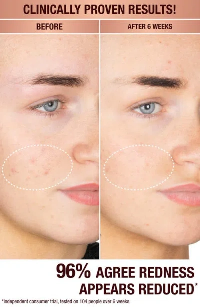 Charlotte Tilbury Dark Spot Correcting Radiance Recovery Serum In No Color