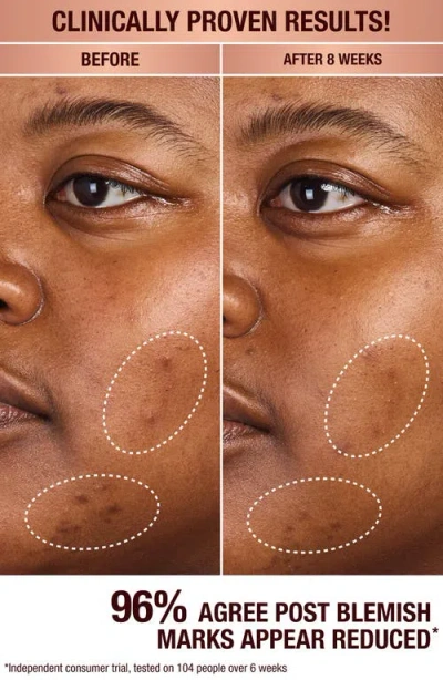 Charlotte Tilbury Dark Spot Correcting Radiance Recovery Serum In No Color