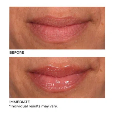 Dr. Nassif Skincare Hydro-screen For Lips In Pink Champagne
