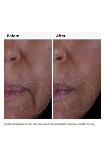 The Ordinary Gf 15% Solution In No Color